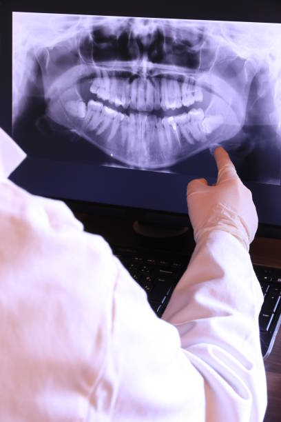 Best Emergency Treatment for Dental Infections or Abscesses in Point Of Rocks, MD