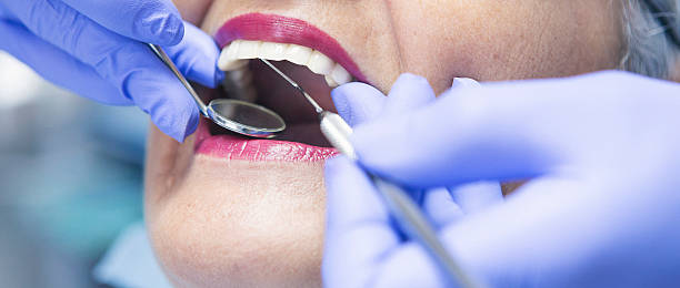 Best Emergency Tooth Extraction in Point Of Rocks, MD